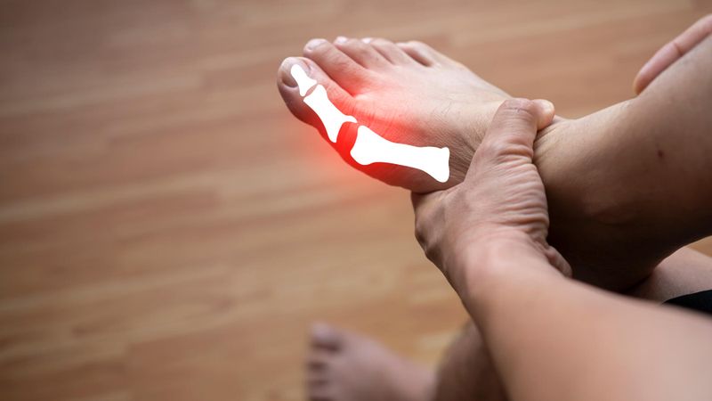 Illustration d'une douleur articulaire au gros orteil